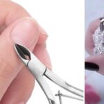 Ongles cassants : causes et traitements