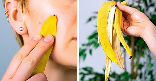 Les excellentes propriétés de la peau de banane