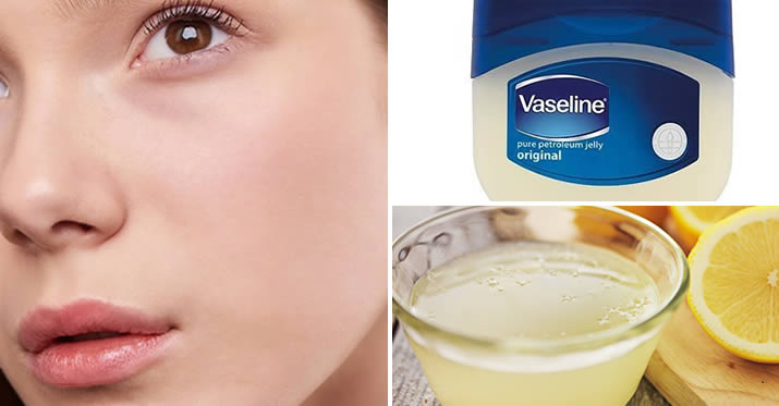 Vaseline, citron et vitamine E : comment les combiner pour avoir une peau de porcelaine