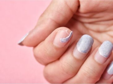 Ongles cassants : causes et traitements