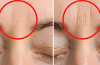 Comment réduire l’apparence des rides entre les sourcils avec cette recette naturelle